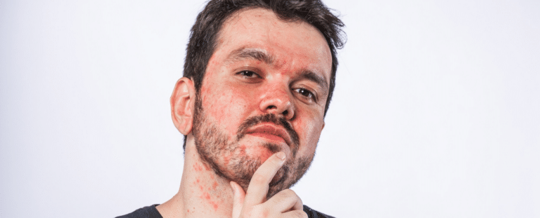 Eno se une a Gaules para combater preconceito na comunidade gamer